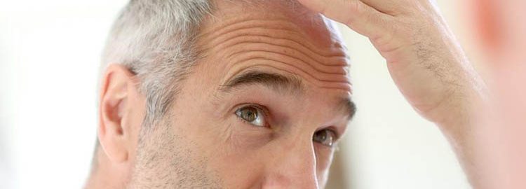 Przeszczep włosów Poznań